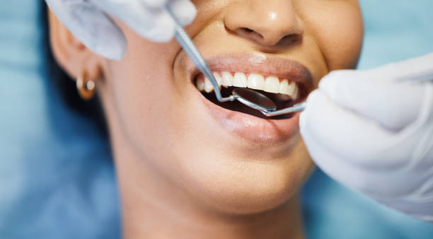 Best Emergency Dental Care for Abscessed Tooth in Mccla, AL