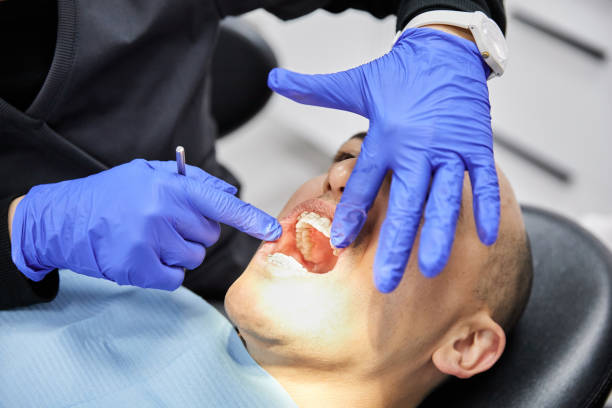 Best Emergency Dentist for Knocked-Out Tooth in Mccla, AL